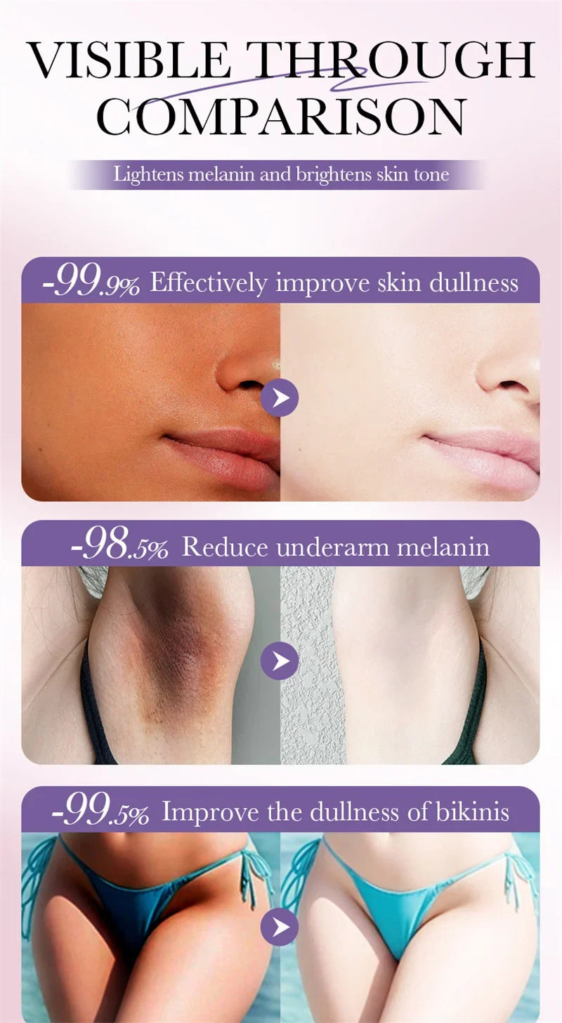 Feeling Embarrassed by Dark Spots? – Discover the Intimate Whitening Cream for Confidence & Radiant Skin