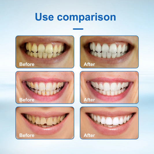 Oh My God! Yellow Teeth No More – Fast Whitening Essence for a Bright Smile