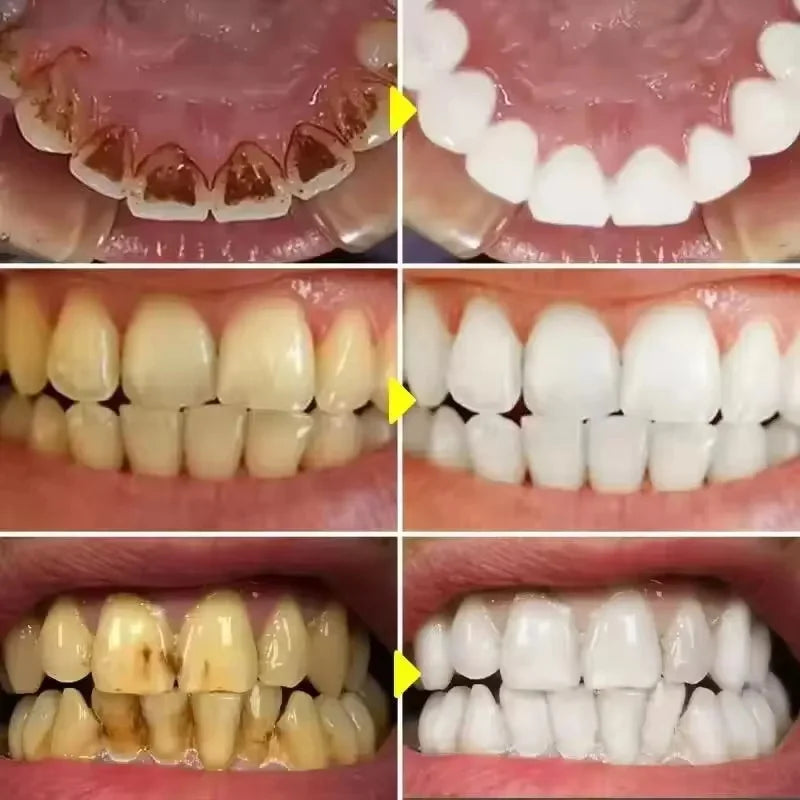 Oh My God! Yellow Teeth No More – Fast Whitening Essence for a Bright Smile