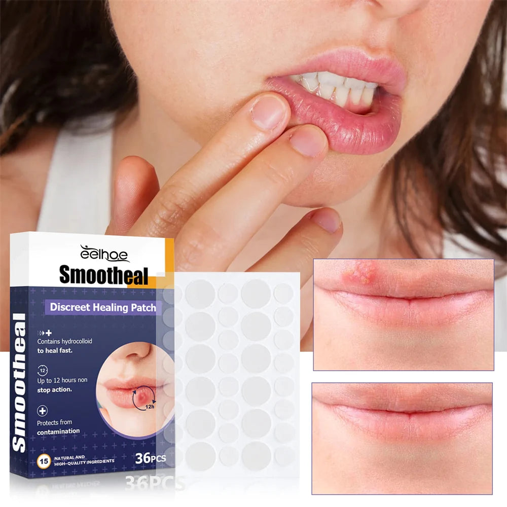 Herpes Shield™ – Clear & Confident in Minutes
