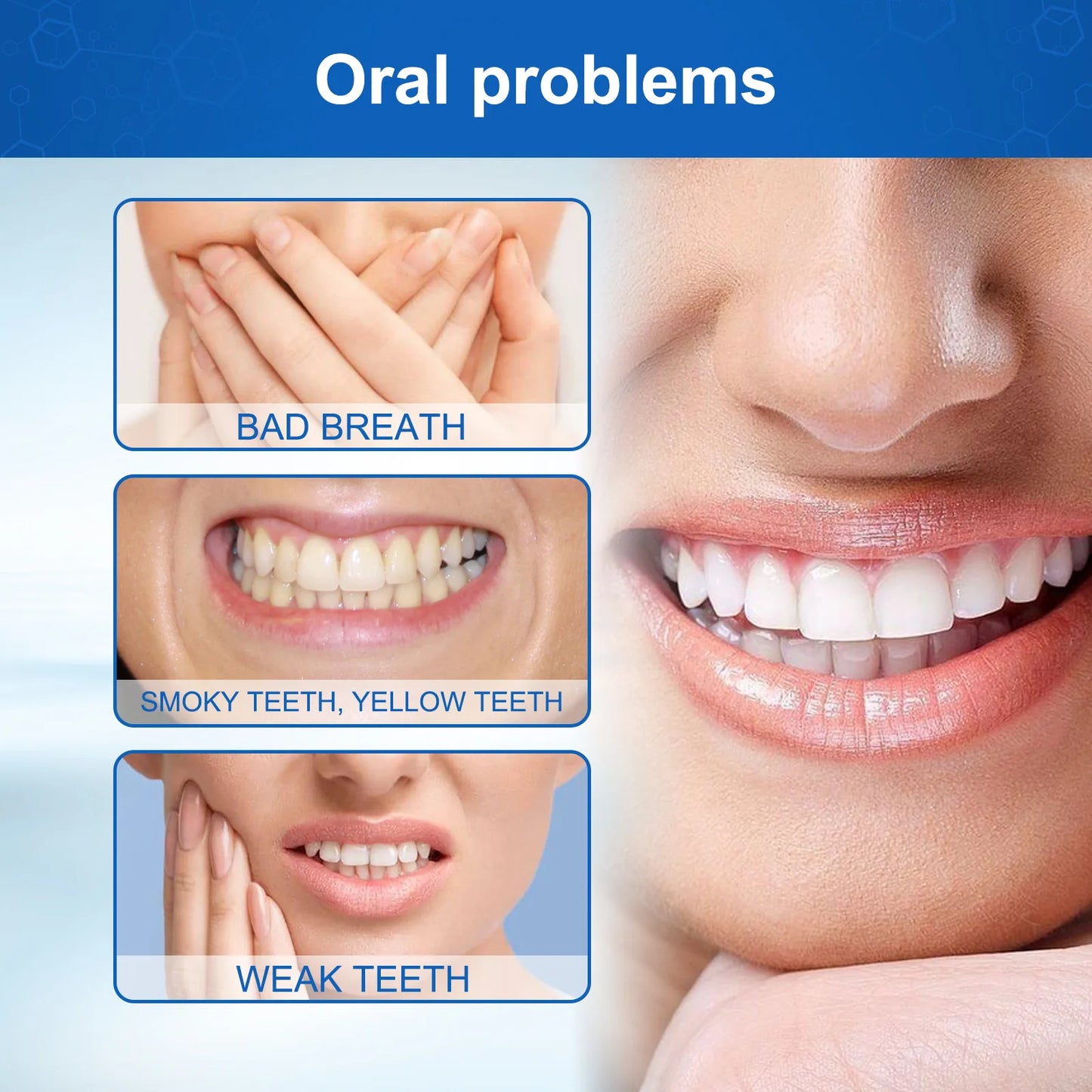 Oh My God! Yellow Teeth No More – Fast Whitening Essence for a Bright Smile