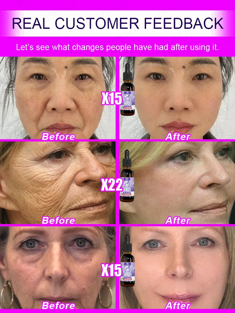 Youth Restore – Look 20 Years Younger