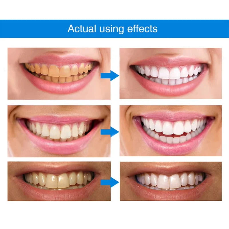 Oh My God! Yellow Teeth No More – Fast Whitening Essence for a Bright Smile
