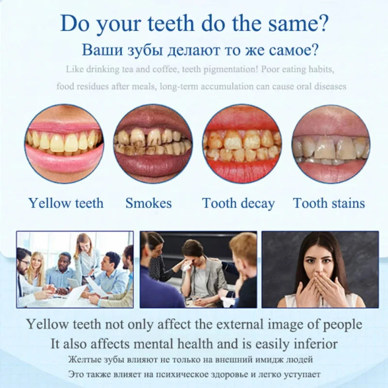 Oh My God! Yellow Teeth No More – Fast Whitening Essence for a Bright Smile