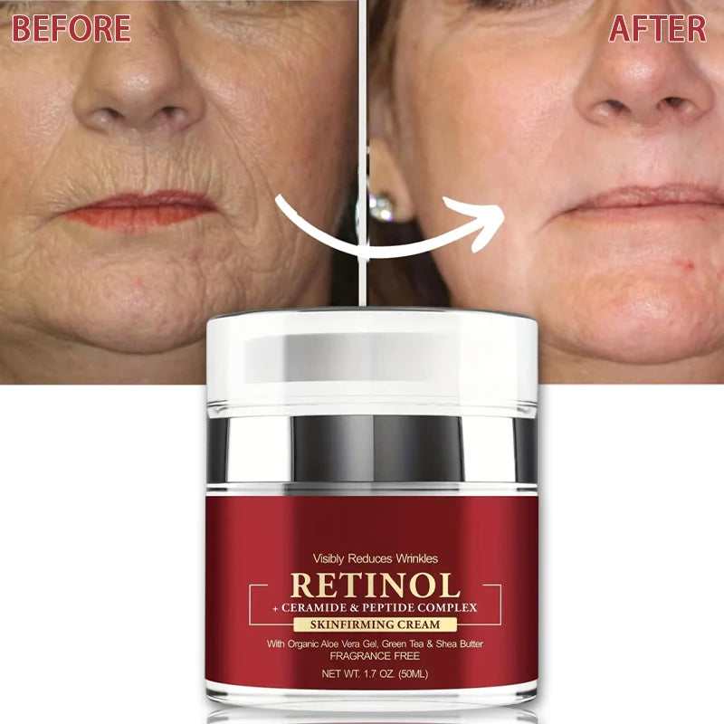 Essentiva™ Retinol – The Celebrity Secret for Youthful, Radiant Skin