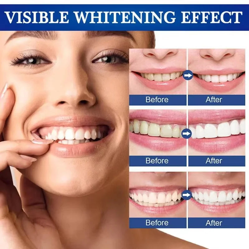 Oh My God! Yellow Teeth No More – Fast Whitening Essence for a Bright Smile