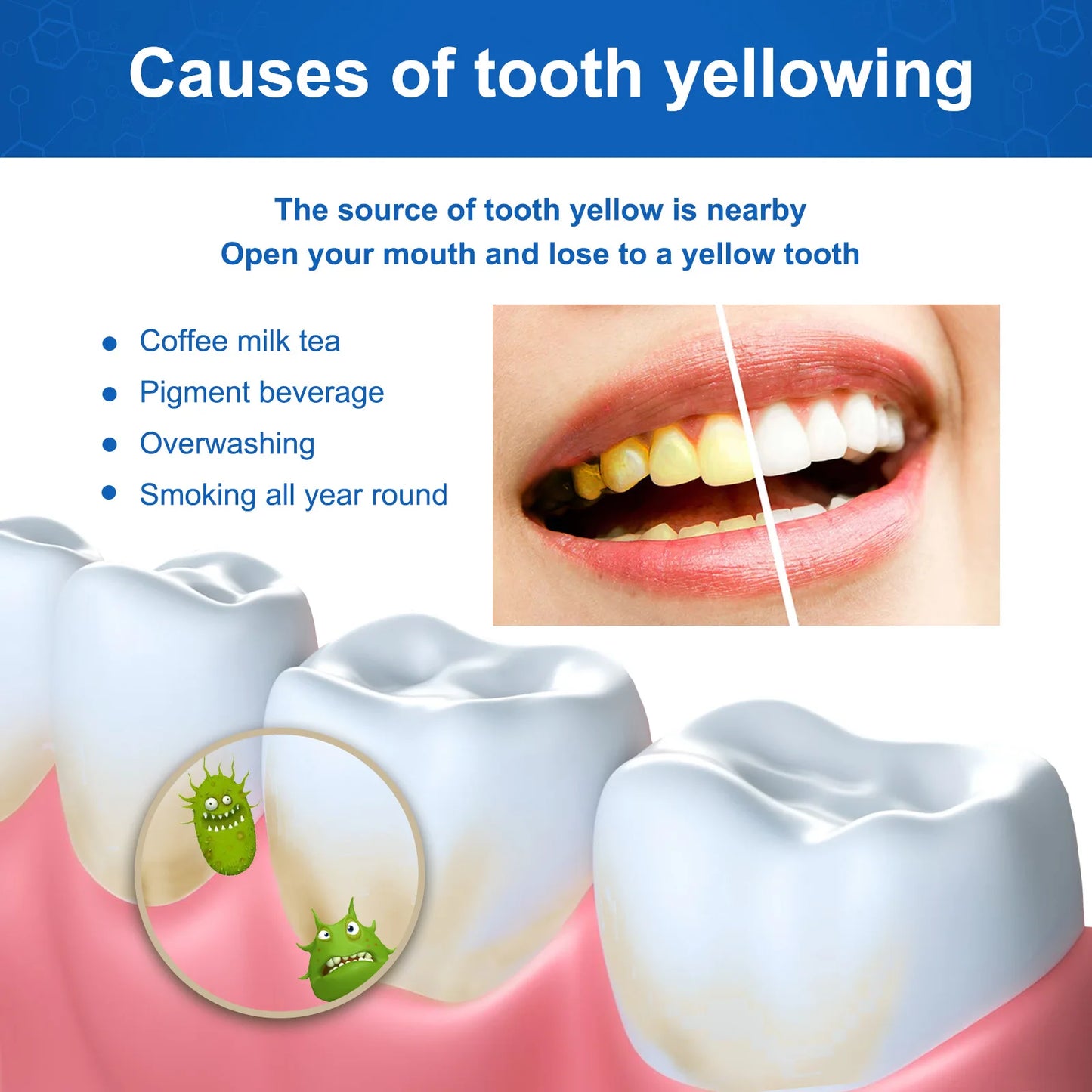 Oh My God! Yellow Teeth No More – Fast Whitening Essence for a Bright Smile