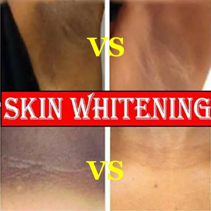 Feeling Embarrassed by Dark Spots? – Discover the Intimate Whitening Cream for Confidence & Radiant Skin