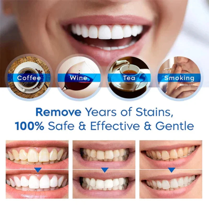 Oh My God! Yellow Teeth No More – Fast Whitening Essence for a Bright Smile