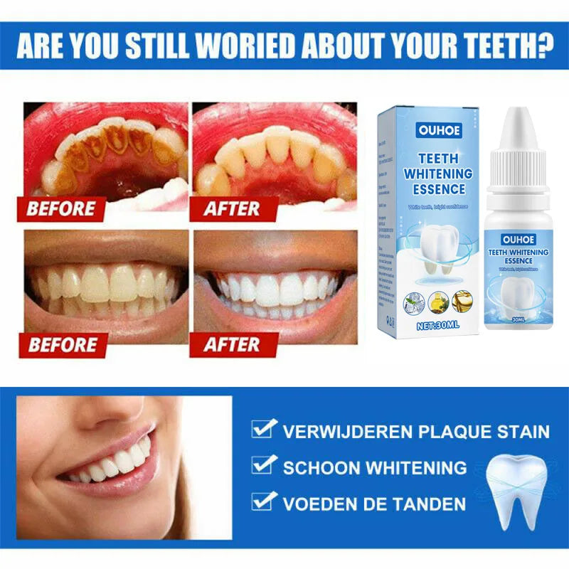 Oh My God! Yellow Teeth No More – Fast Whitening Essence for a Bright Smile