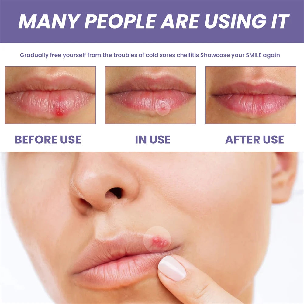 Herpes Shield™ – Clear & Confident in Minutes