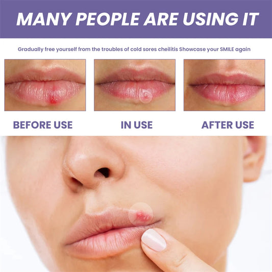 Herpes Shield™ – Clear & Confident in Minutes