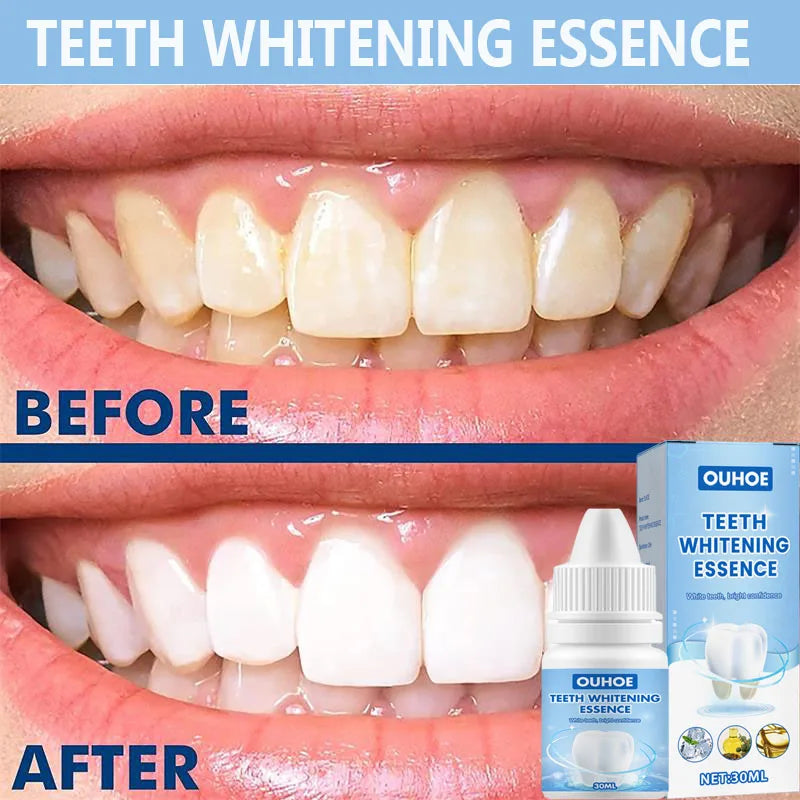 Oh My God! Yellow Teeth No More – Fast Whitening Essence for a Bright Smile
