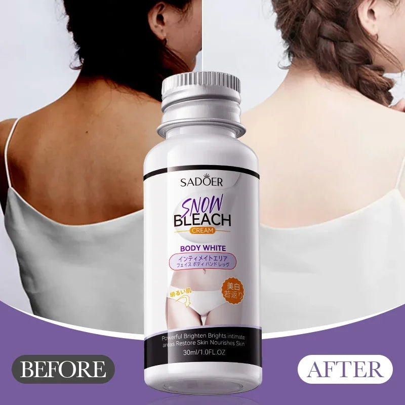 Feeling Embarrassed by Dark Spots? – Discover the Intimate Whitening Cream for Confidence & Radiant Skin