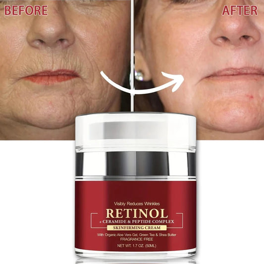 Essentiva™ Retinol – The Celebrity Secret for Youthful, Radiant Skin
