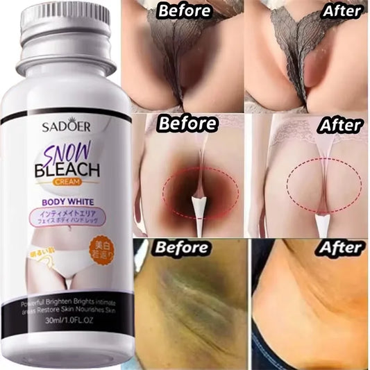 Feeling Embarrassed by Dark Spots? – Discover the Intimate Whitening Cream for Confidence & Radiant Skin